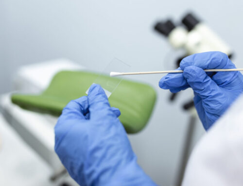 Do We Still Need Pap Smears? A Modern Take on Cervical Cancer Screening